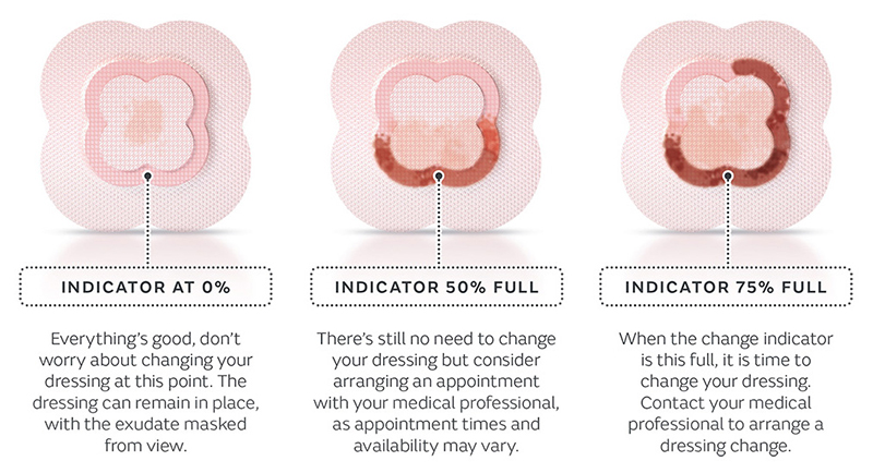 allevyn-change-indicator